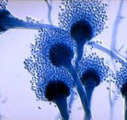 ASPERGILLUS